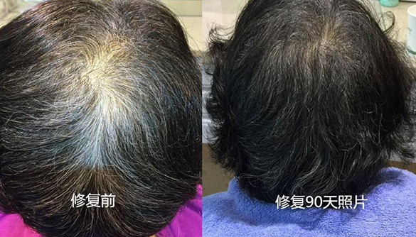 美诗秀消费者案例